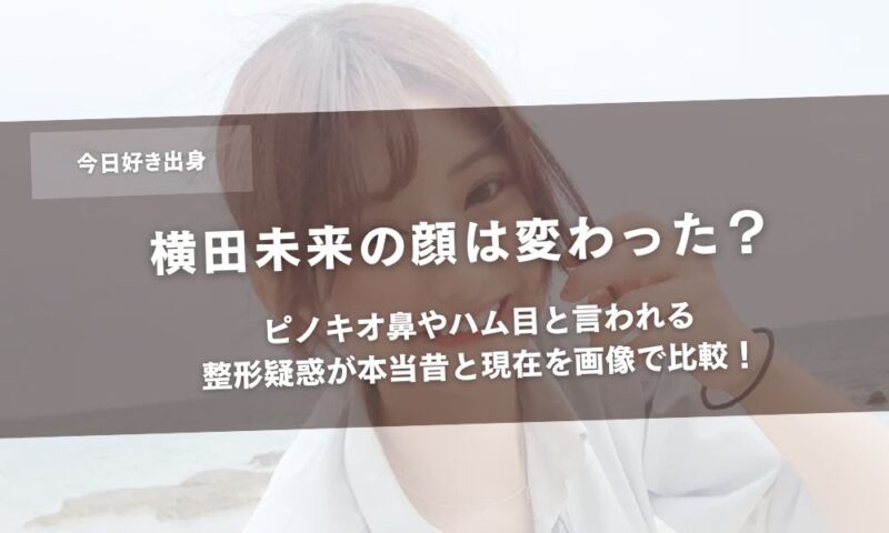 横田未来の顔は変わった?ピノキオ鼻やハム目と言われる整形疑惑が本当昔と現在を画像で比較!アイキャッチ